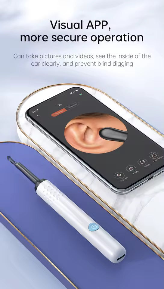 Smart Earwax Remover with 1080P Camera for Android & iPhone (Imported)