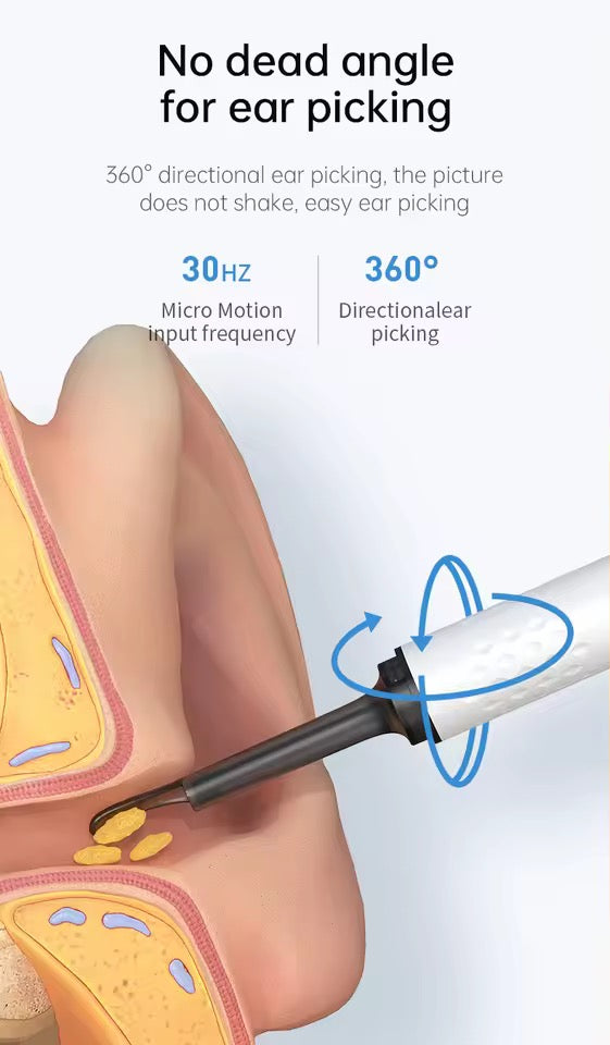 Smart Earwax Remover with 1080P Camera for Android & iPhone (Imported)