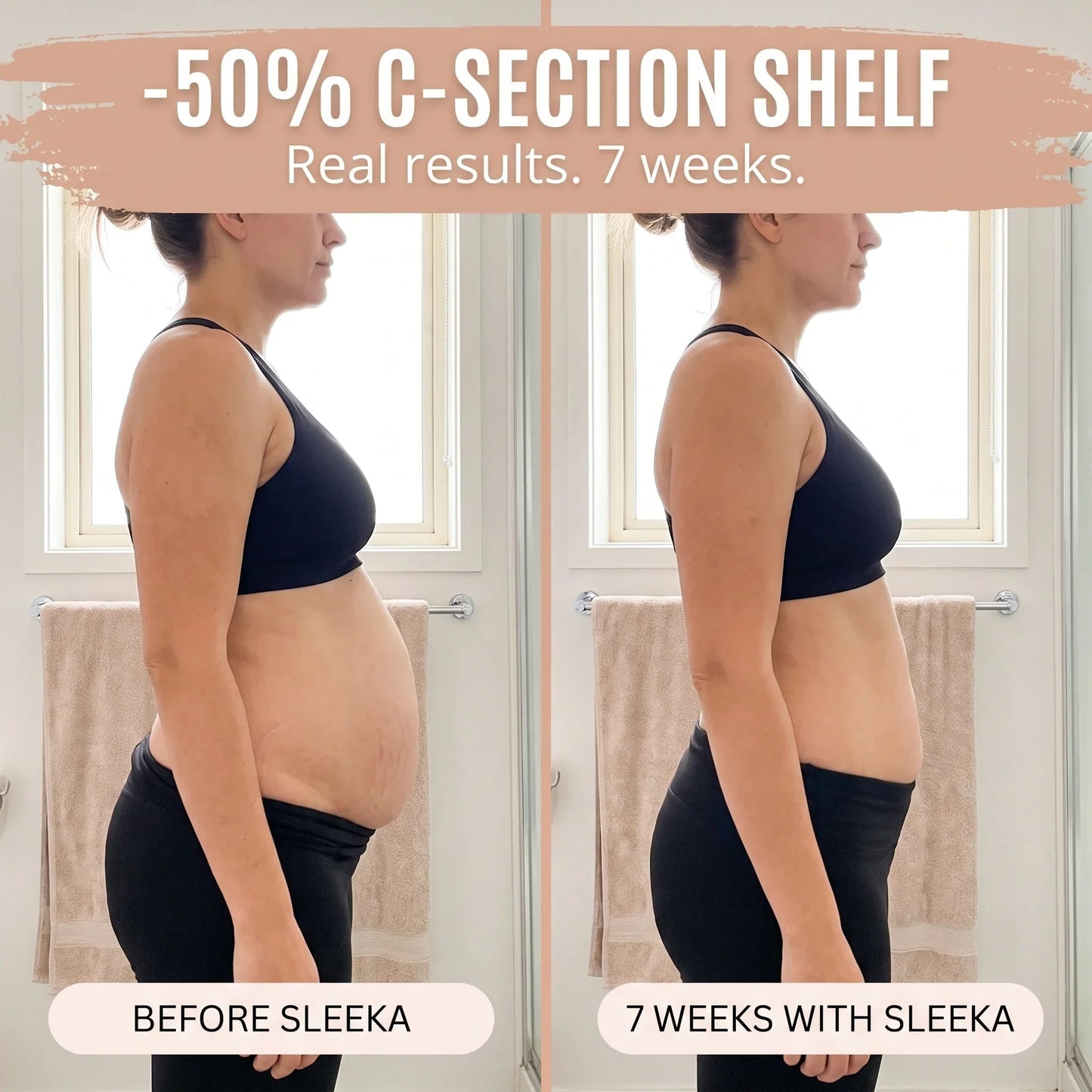 Postpartum Recovery Brief — 360° Compression